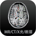 影像解剖图谱人体断层影像图集和病例大全v4.4.3