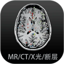 影像解剖图谱安卓手机版v4.4.3
